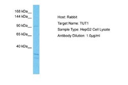 TUT1 Rabbit anti-Human, Polyclonal, Novus Biologicals 0.1ml; Unconjugated:Antibodies,