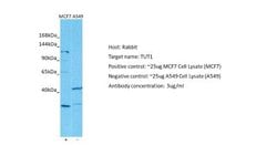 TUT1 Rabbit anti-Human, Polyclonal, Novus Biologicals 0.1ml; Unconjugated:Antibodies,