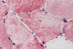 TXLNB Antibody, Novus Biologicals 50 &mu;g | Buy Online | Novus Biologicals | Fisher Scientific