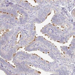 TXNDC6 Antibody, Novus Biologicals 25 &mu;L, Unconjugated:Antibodies, Polyclonal