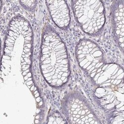 TXNDC6 Antibody, Novus Biologicals 25 &mu;L, Unconjugated:Antibodies, Polyclonal