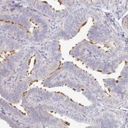 TXNDC6 Antibody, Novus Biologicals 25 &mu;L, Unconjugated:Antibodies, Polyclonal