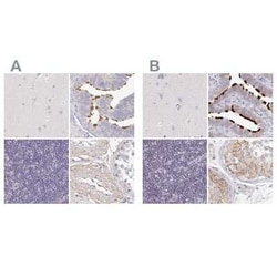 TXNDC6 Antibody, Novus Biologicals 25 &mu;L, Unconjugated:Antibodies, Polyclonal