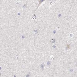 TXNDC6 Antibody, Novus Biologicals 25 &mu;L, Unconjugated:Antibodies, Polyclonal