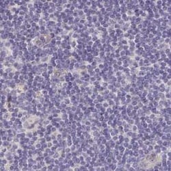 TXNDC6 Antibody, Novus Biologicals 25 &mu;L, Unconjugated:Antibodies, Polyclonal