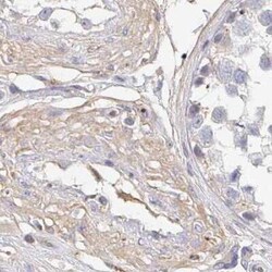 TXNDC6 Antibody, Novus Biologicals 25 &mu;L, Unconjugated:Antibodies, Polyclonal