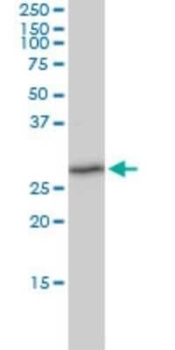 TXNDC9 Antibody (1E8-7C12), Novus Biologicals 0.1 mg | Buy Online | Novus Biologicals | Fisher Scientific