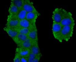 TXNIP Antibody (JM60-35), Novus Biologicals 100 &mu;l; Unconjugated:Antibodies,