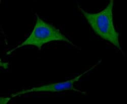 TXNIP Antibody (JM60-35), Novus Biologicals 100 &mu;l; Unconjugated:Antibodies,
