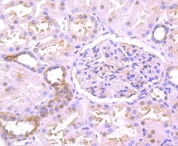 TXNIP Antibody (JM60-35), Novus Biologicals 100 &mu;l; Unconjugated:Antibodies,