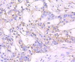 TXNIP Antibody (JM60-35), Novus Biologicals 100 &mu;l; Unconjugated:Antibodies,