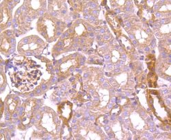 TXNIP Antibody (JM60-35), Novus Biologicals 100 &mu;l; Unconjugated:Antibodies,