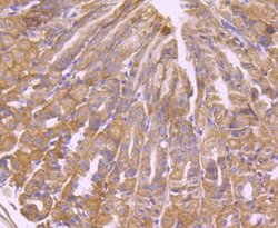 TXNIP Antibody (JM60-35), Novus Biologicals 100 &mu;l; Unconjugated:Antibodies,