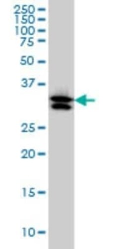TXNL1 Antibody (1A10), Novus Biologicals 0.1 mg | Buy Online | Novus Biologicals | Fisher Scientific