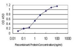 TXNL4A Antibody (1C4), Novus Biologicals 0.1 mg | Buy Online | Novus Biologicals | Fisher Scientific