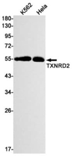 TXNRD2 Antibody (S02-2D6), Novus Biologicals:Antibodies:Primary Antibodies