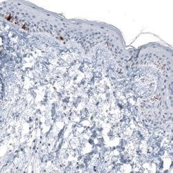 TYRP1 Antibody (CL4906), Novus Biologicals:Antibodies:Primary Antibodies