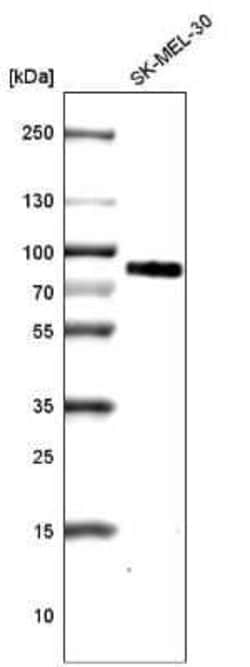 TYRP1 Antibody (CL4906), Novus Biologicals:Antibodies:Primary Antibodies
