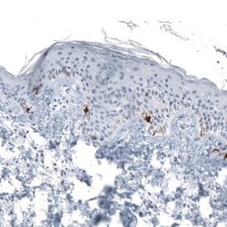 TYRP1 Antibody (CL4917), Novus Biologicals 25 &mu;L:Antibodies, Monoclonal