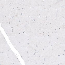 TYRP1 Antibody (CL4917), Novus Biologicals 25 &mu;L:Antibodies, Monoclonal