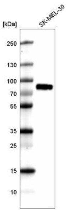TYRP1 Antibody (CL4917), Novus Biologicals 25 &mu;L:Antibodies, Monoclonal