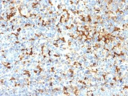 TYRP1 Antibody (TYRP1/2340R) - Azide and BSA Free, Novus Biologicals 100 &mu;g | Buy Online | Novus Biologicals | Fisher Scientific