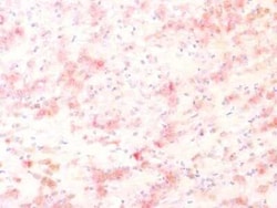 TYRP1 Antibody (TYRP1/1564R), Novus Biologicals:Antibodies:Primary Antibodies