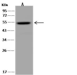 TYSND1 Antibody, Novus Biologicals:Antibodies:Primary Antibodies