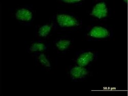 TZFP Antibody, Novus Biologicals 0.05 mg | Buy Online | Novus Biologicals | Fisher Scientific