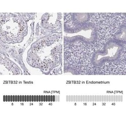 TZFP Antibody, Novus Biologicals 25ul; Unconjugated:Antibodies, Polyclonal