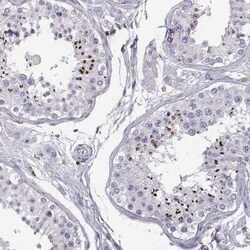 TZFP Antibody, Novus Biologicals 25ul; Unconjugated:Antibodies, Polyclonal