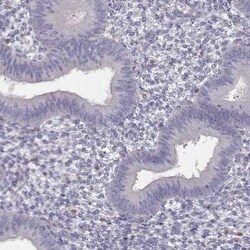 TZFP Antibody, Novus Biologicals 25ul; Unconjugated:Antibodies, Polyclonal