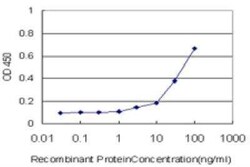 Tafazzin/TAZ Antibody (1B10), Novus Biologicals 0.1 mg | Buy Online | Novus Biologicals | Fisher Scientific