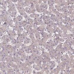 Tafazzin/TAZ Antibody, Novus Biologicals:Antibodies:Primary Antibodies