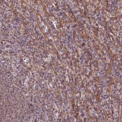 Tafazzin/TAZ Antibody, Novus Biologicals:Antibodies:Primary Antibodies