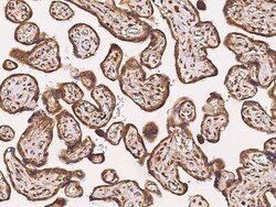 Tafazzin/TAZ Antibody, Novus Biologicals:Antibodies:Primary Antibodies