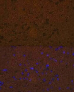 Talin2 Rabbit anti-Human, Mouse, Rat, Clone: 7D1Y0, Novus Biologicals 100