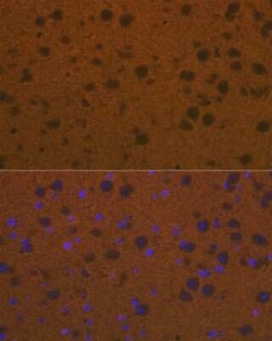 Talin2 Rabbit anti-Human, Mouse, Rat, Clone: 7D1Y0, Novus Biologicals 100