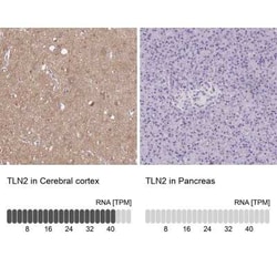 Talin2 Antibody, Novus Biologicals:Antibodies:Primary Antibodies