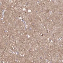 Talin2 Antibody, Novus Biologicals:Antibodies:Primary Antibodies