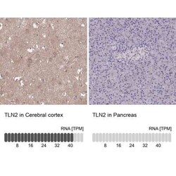 Talin2 Antibody, Novus Biologicals:Antibodies:Primary Antibodies