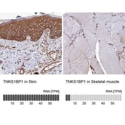 Tankyrase binding protein 1 Antibody, Novus Biologicals:Antibodies:Primary