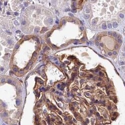 Tankyrase binding protein 1 Antibody, Novus Biologicals:Antibodies:Primary