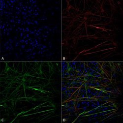 Tau Antibody (1D5) - Pre-formed Fibrils, Novus Biologicals 0.1 mg; Unconjugated:Antibodies,