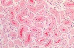 Tau Antibody, Novus Biologicals 100 &mu;g; Unconjugated:Antibodies, Polyclonal