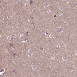 Tau Antibody, Novus Biologicals:Antibodies:Primary Antibodies