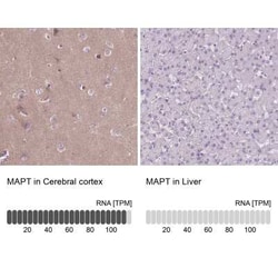 Tau Antibody, Novus Biologicals:Antibodies:Primary Antibodies