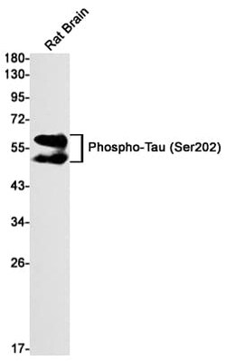 Tau, p Ser202 Antibody (S01-5A7), Novus Biologicals 100 &mu;g; Unconjugated:Antibodies,