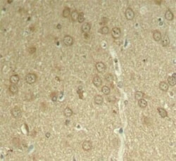 Tau Rabbit anti-Human, Mouse, Rat, Polyclonal, Novus Biologicals 20 &mu;g | Buy Online | Novus Biologicals | Fisher Scientific