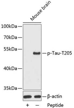 Tau Rabbit anti-Human, Mouse, Rat, Polyclonal, Novus Biologicals 20 &mu;g | Buy Online | Novus Biologicals | Fisher Scientific